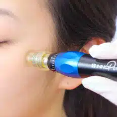 Clinical Spa Services