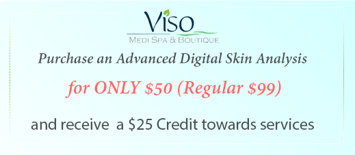 Viso Coupon