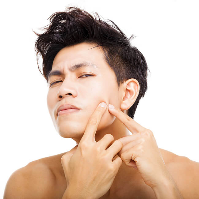 pimple