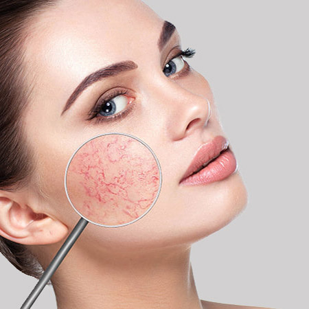 How long does the treatment take?